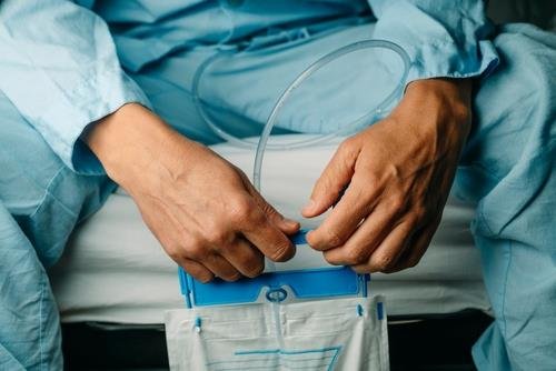 the essentials of choosing the right catheters