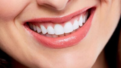 smile makeovers for modern living