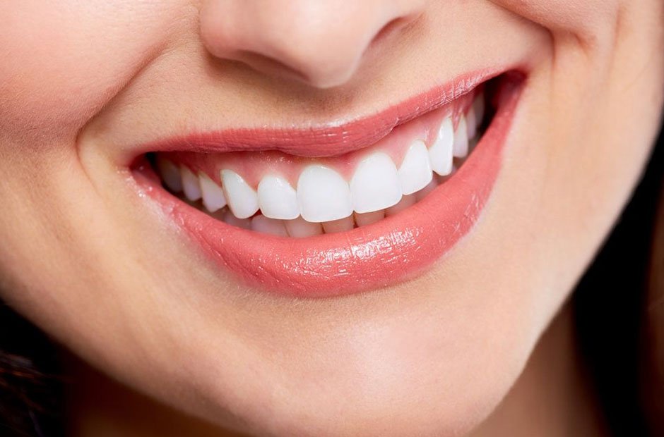 smile makeovers for modern living