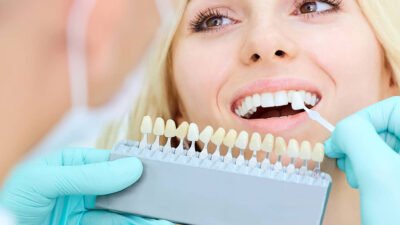 what to expect when getting porcelain veneers