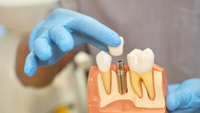 advancements in dental implant technology
