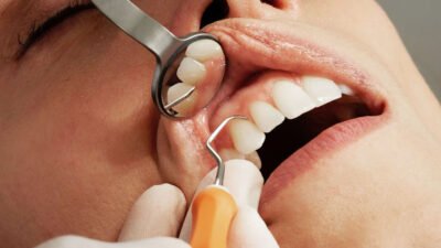 3 signs it’s time to visit your general dentist for a checkup