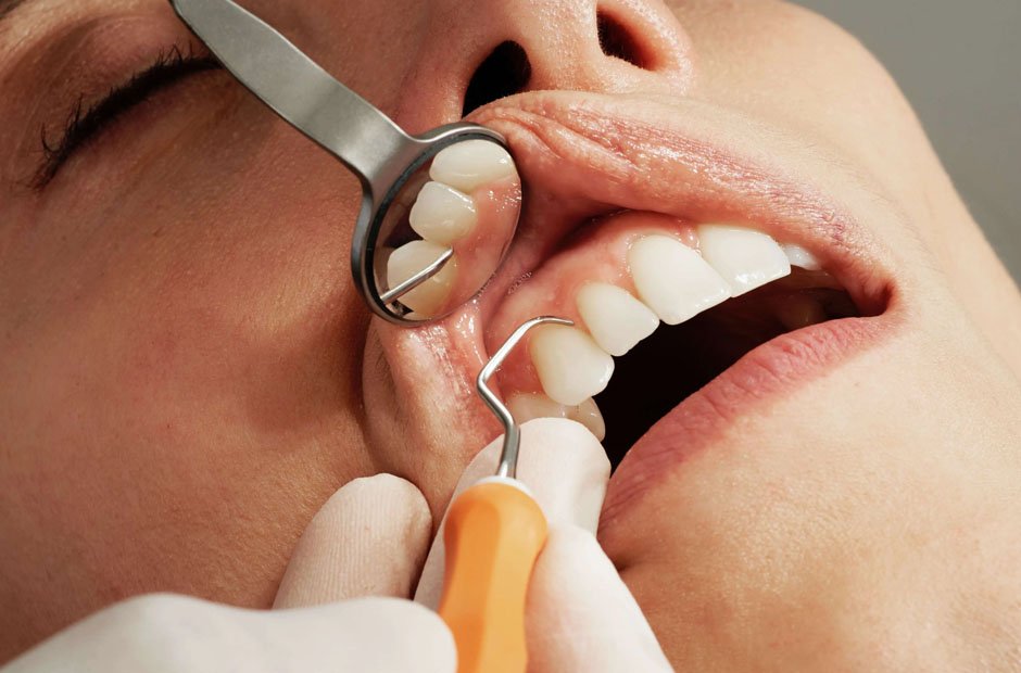 3 signs it’s time to visit your general dentist for a checkup