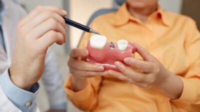 3 signs you might be a candidate for implants at your family dentist
