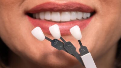 4 signs it’s time to consider cosmetic dental improvements