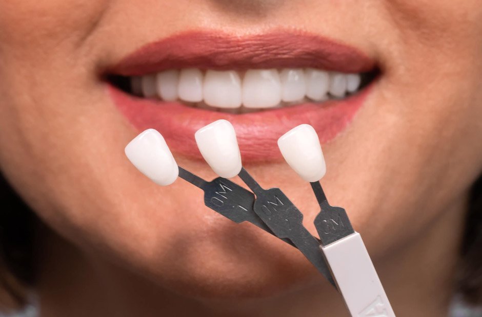 4 signs it’s time to consider cosmetic dental improvements
