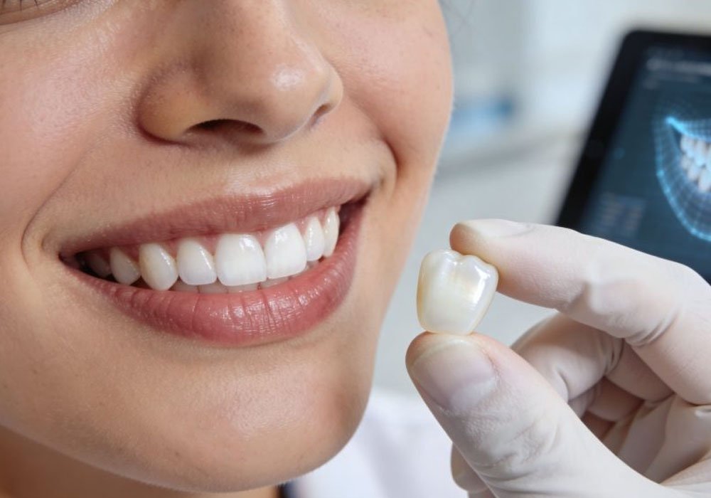 long term maintenance plans that make cosmetic dentistry last