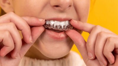 why nightguards are often recommended for teeth grinding