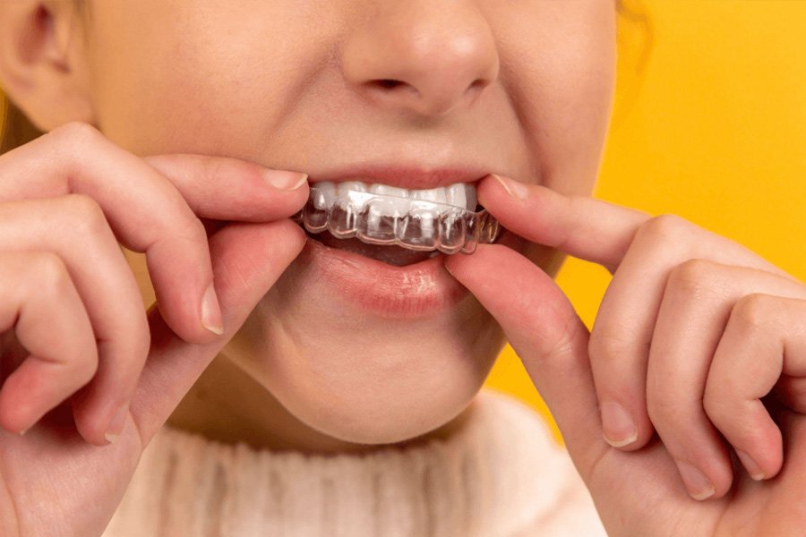 why nightguards are often recommended for teeth grinding