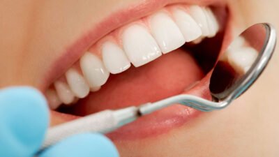3 things to know about cosmetic gum contouring in a family dental practice
