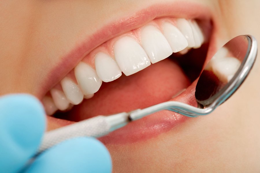 3 things to know about cosmetic gum contouring in a family dental practice