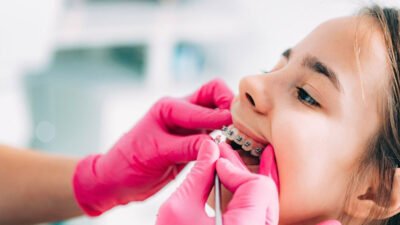 6 tips for parents supporting kids in orthodontic treatment