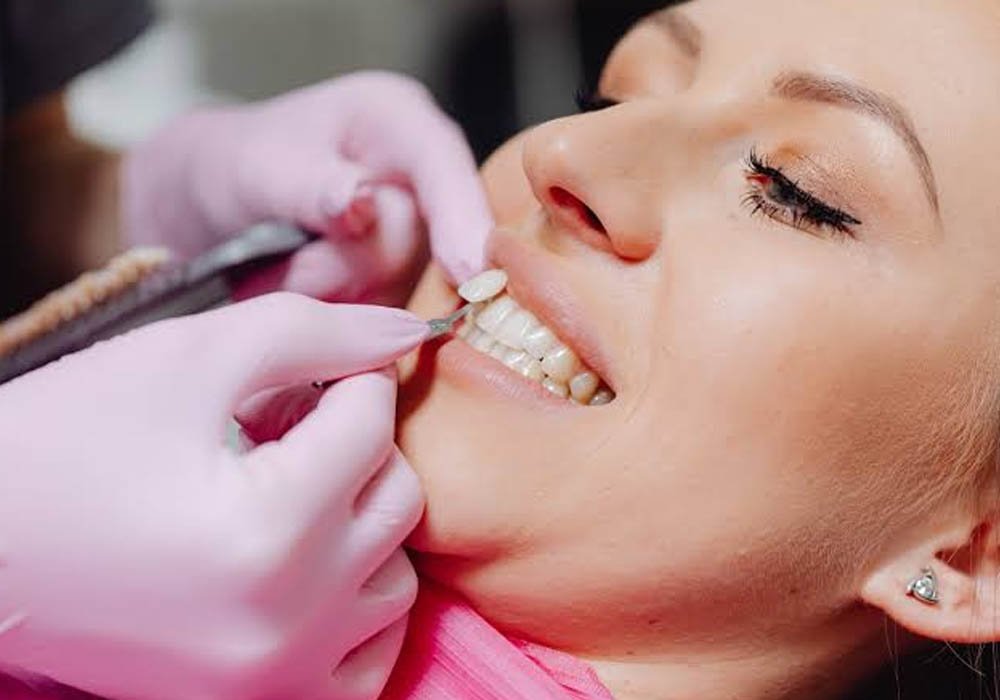 seasonal scheduling strategies for family dental cleanings and cosmetic visits
