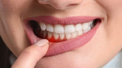 5 ways periodontics and implant dentistry work together