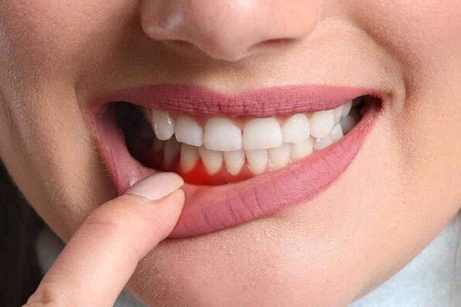 5 ways periodontics and implant dentistry work together